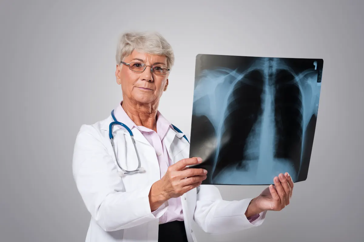pneumocystoza