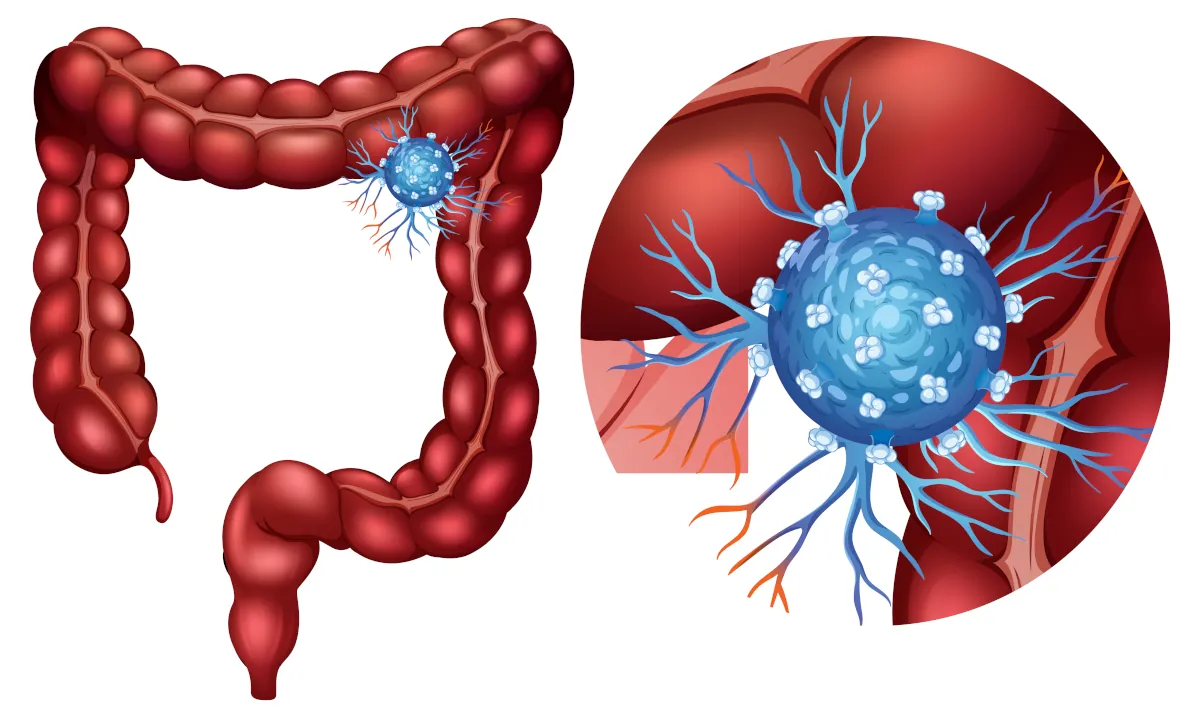 flora bakteryjna jelit