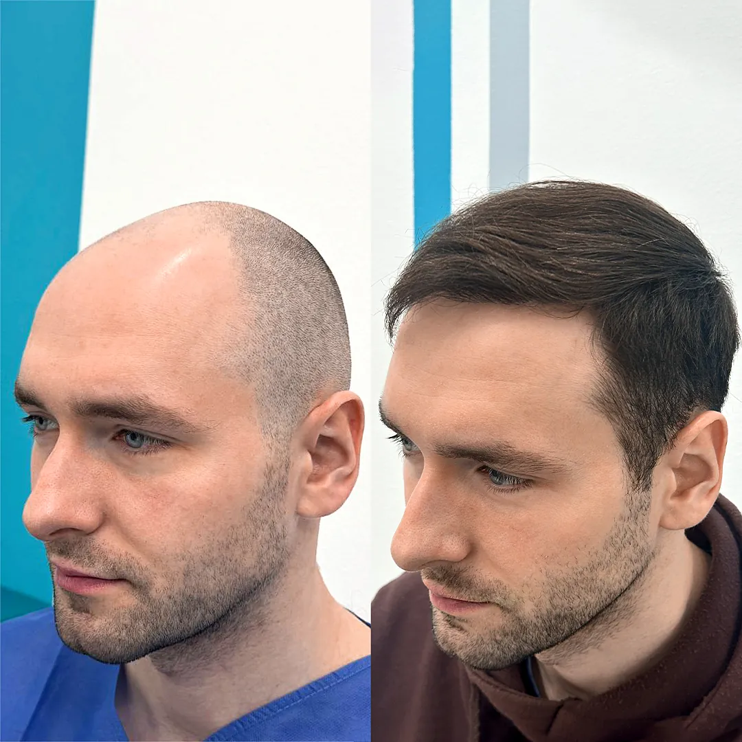 FullFace_Clinic