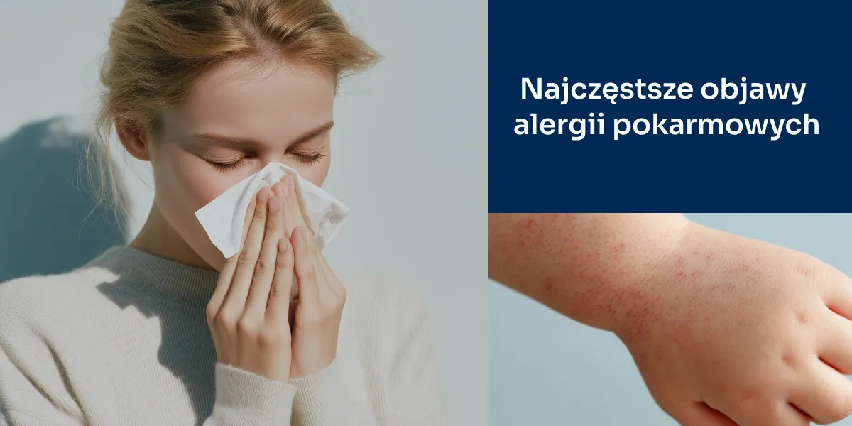 alergia pokarmowa objawy
