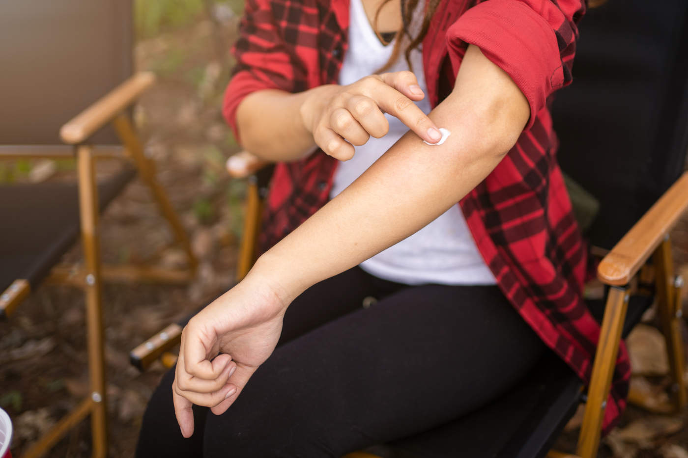 Ugryzienie komara - jak załagodzić ból i swędzenie?