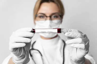 Kiedy zrobić test na HIV? Wskazania i okno serologiczne